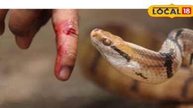 Snake Bite: In case of snake bite, first aid doctor, keep these things in mind