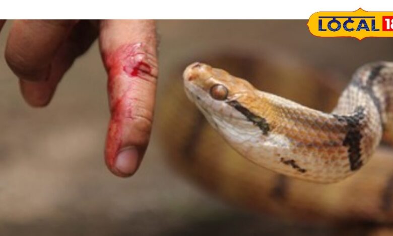 Snake Bite: In case of snake bite, first aid doctor, keep these things in mind