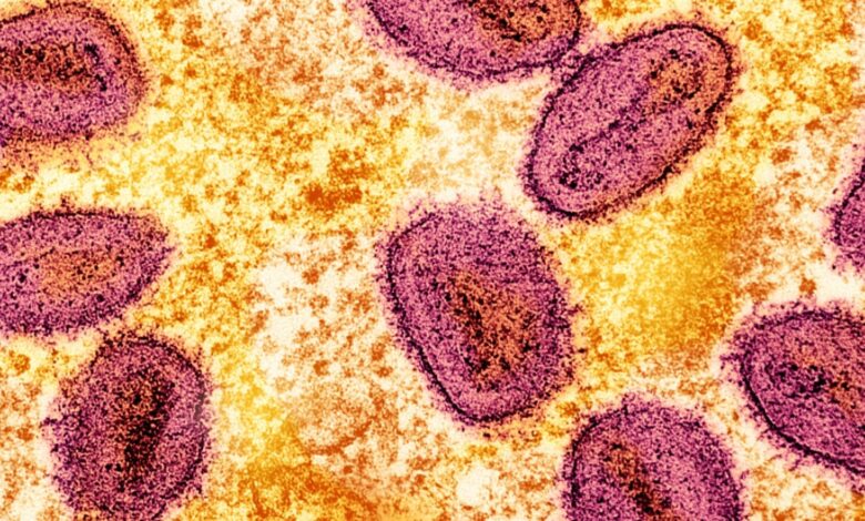 Mpox New Strain Reported in Sweden, Marks the First Case Outside of Africa