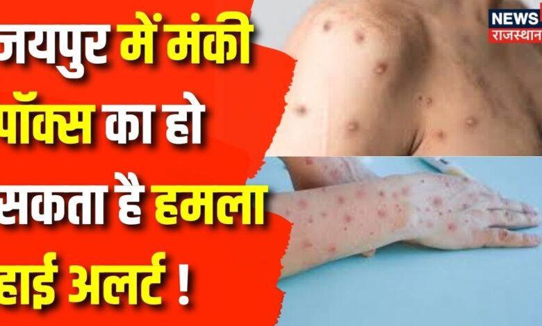 Jaipur News : Monkey Pox को लेकर जयपुर में हाई अलर्ट | Rajasthan News | Monkey Pox | WHO | Top News – News18 हिंदी