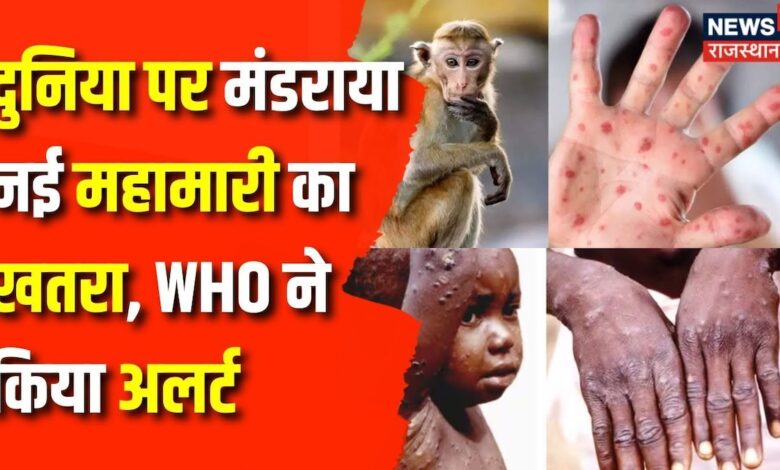 Rajasthan News : Mankey Pox को लेकर भारत में अलर्ट | Monkey Pox | Jaipur News | WHO