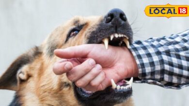 Dog Bite remedy: कुत्ते के काटने पर तुरंत करें ये काम, वरना हो सकता है बड़ा नुकसान, जानें एक्सपर्ट की राय