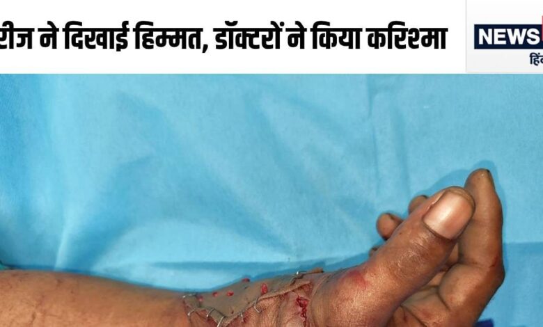 कलाई से कटकर अलग गिरा हाथ, खुद ही अस्पताल लेकर पहुंचा मरीज, फिर जो हुआ....