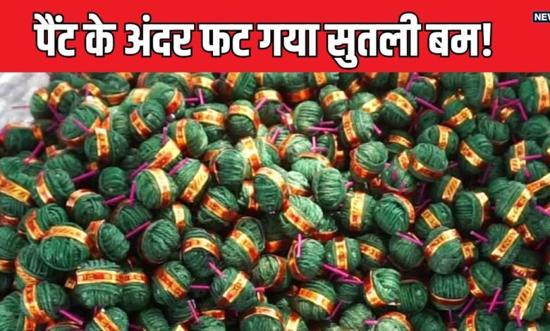 जेब में सुतली बम रखकर घूम रहा था लड़का, अचानक लग गई आग, उड़ गया प्राइवेट पार्ट!