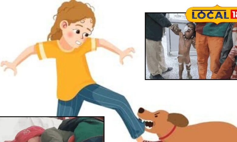 पाली में डॉग्स का आतंक: 3 वर्षीय मासूम पर 5 कुत्तों का हमला