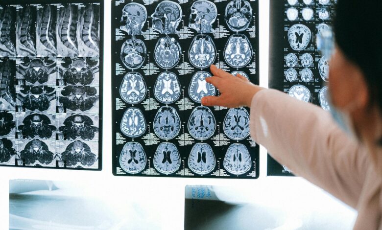 What Happens To Human Brain Just Before We Die? Scientists May Have The Answer