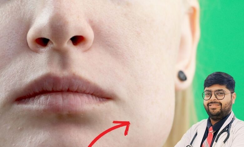 Is swelling on the face dangerous Causes symptoms and remedies explained by Doctor Varun Khanna of Noida | चेहरे की सूजन के कारण और उपाय: डॉ. वरुण सुरेश खन्ना का सुझाव.