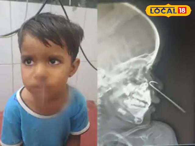 बच्ची