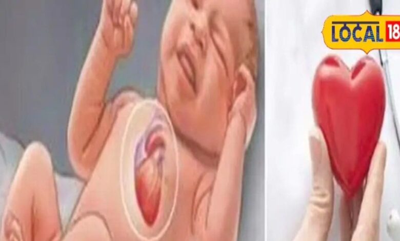 Free Heart Surgery: पाली के 5 बच्चों का दिल का ऑपरेशन निशुल्क, जयपुर में स्क्रीनिंग