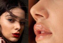 Cracked Lips Due to Vitamin B and C Deficiency : जानिए कौन से विटामिन की कमी से फटते हैं होंठ
