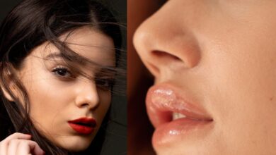 Cracked Lips Due to Vitamin B and C Deficiency : जानिए कौन से विटामिन की कमी से फटते हैं होंठ