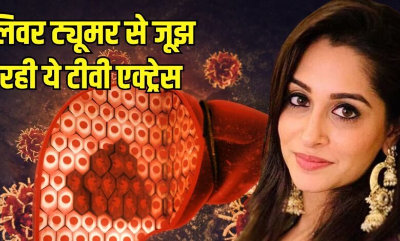 Deepika Kakkar battling liver tumor fans praying for her know symptoms of Disease in hindi | कैंसर तो नहीं... पर जानलेवा है लिवर ट्यूमर! टीवी एक्ट्रेस दीपिका कक्कड़ बीमारी का कर रहीं सामना, जानें इसके लक्षण