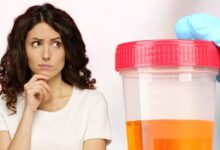 Dehydration Cause Dark Yellow Urine in Summer : गर्मी में डिहाइड्रेशन से पेशाब का रंग हो सकता है गहरा पीला, डॉक्टर बोले इससे बचने के लिए खूब पिएं पानी