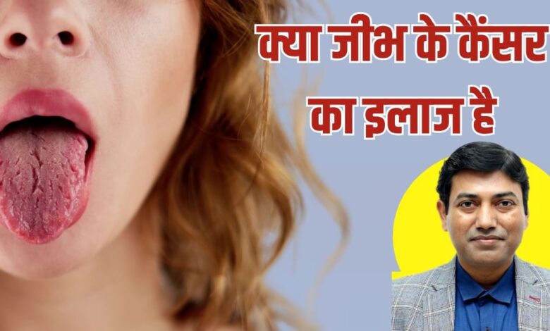 दिल्ली में डॉक्टरों ने जीभ के कैंसर का सफल इलाज किया: लक्षण और बचाव.
