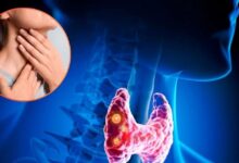 How to detect Thyroid Primary Symptoms|ये 5 संकेत बताते हैं कि थायरायड की शुरुआत हो चुकी है
