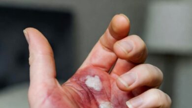 दीपावली की रोशनी बुझी, अरावली विहार में मासूम की आंखों से छिन गई रौशनी, पटाखे की चिंगारी बनी ज़िंदगी का अंधेरा!