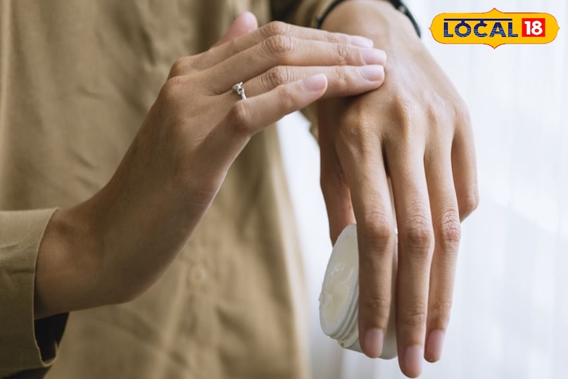 ठंड में बाहर निकलते समय हाथो में दस्ताने पहनने चाहिए ठंड में बाहर निकलते समय हाथो में दस्ताने पहनने चाहिए