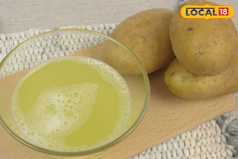 अंडरआर्म्स के कालेपन से छुटकारा पाएं इन 5 घरेलू नुस्खों से, कुछ हफ्तों में दिखेगा असर. अंडरआर्म्स के कालेपन से छुटकारा पाएं इन 5 घरेलू नुस्खों से, कुछ हफ्तों में दिखेगा असर.