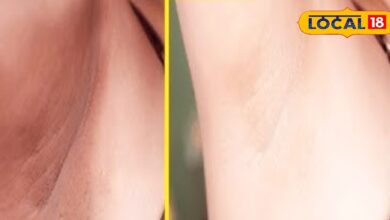 Home Remedies for Dark Underarms