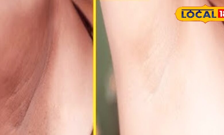 Home Remedies for Dark Underarms