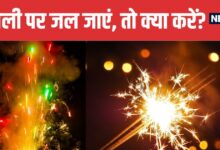 Diwali Burn First Aid Tips You Must Know | दिवाली पर जल जाएं तो अपनाएं डॉक्टर के बताए फर्स्ट एड टिप्स