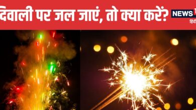 Diwali Burn First Aid Tips You Must Know | दिवाली पर जल जाएं तो अपनाएं डॉक्टर के बताए फर्स्ट एड टिप्स