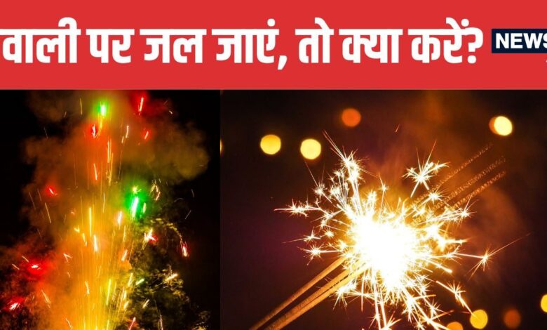 Diwali Burn First Aid Tips You Must Know | दिवाली पर जल जाएं तो अपनाएं डॉक्टर के बताए फर्स्ट एड टिप्स