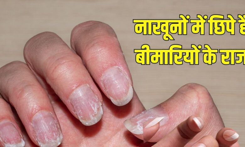 How your nails hidden many disease| आपके नाखूनों में छुपे होते हैं कई बीमारियों के राज