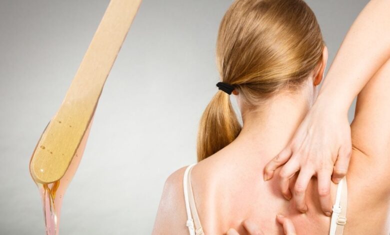 Waxing Bumps Treatment: वैक्सिंग के बाद स्किन पर दाने और खुजली रोकने के लिए असरदार घरेलू उपाय.