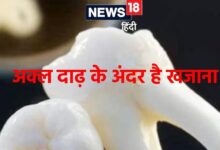 अक्ल दाढ़ में भरा होता है ऐसा खजाना! अब जिससे गंभीर बीमारियों का होगा इलाज, रिसर्च में दावा wisdom teeth stem cells can be revolution in medical treatment research