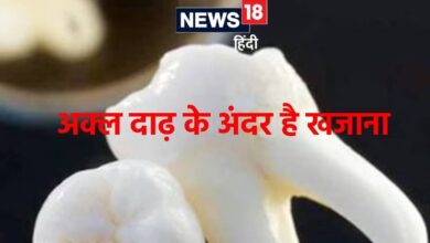 अक्ल दाढ़ में भरा होता है ऐसा खजाना! अब जिससे गंभीर बीमारियों का होगा इलाज, रिसर्च में दावा wisdom teeth stem cells can be revolution in medical treatment research
