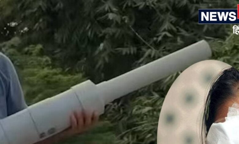 कार्बाइड गन से फूटी सैकड़ों आंखों की रोशनी वापस आएगी या नहीं? एम्स की चीफ डॉक्टर ने बताया सच