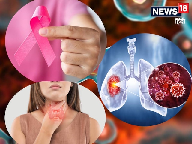 कैंसर हौव्‍वा नहीं! सीधी जंग की तैयारी, 2 महीने में लगेंगे 300 कैंप, 150 डॉक्ट