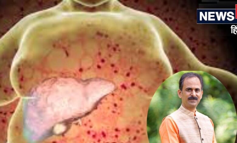 फैटी लिवर की छुट्टी! 4 हफ्तों में बॉडी होगी डिटॉक्स, आचार्य मनीष ने बताया कैसे काम करती है शुद्धि किटpet yakrit pleeha shudhhi kit by acharya manish for fatty liver
