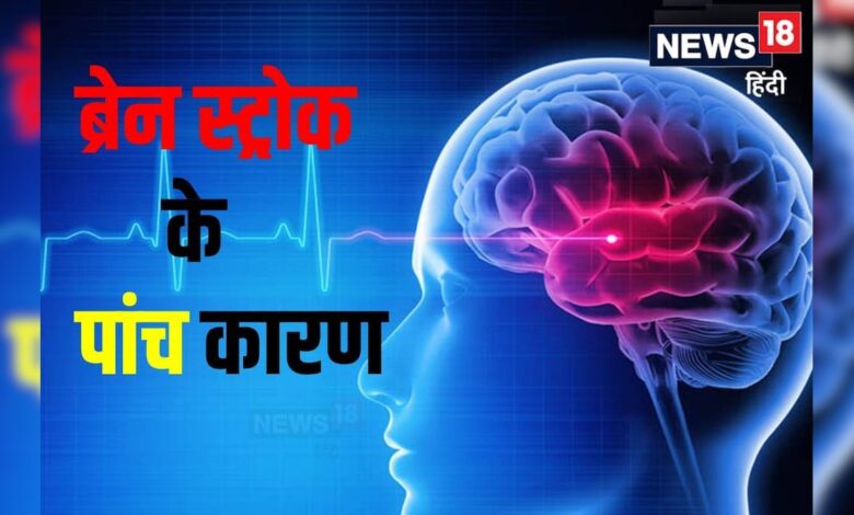 ब्रेन स्‍ट्रोक के ये हैं 5 बड़े कारण, एक को भी क‍िया कंट्रोल तो 40% घटेगा र‍िस्‍क, डॉ. सुनील – News18 हिंदी