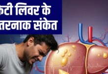 लिवर को अंदर ही अंदर सड़ाने लगता है फैटी लिवर डिजीज, लेकिन इन आयुर्वेदिक नुस्खों से खत्म हो सकती है बीमारी