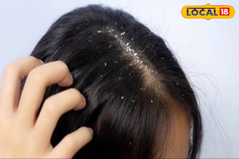 इससे बालों की चमक लौट आती है और रूखापन भी दूर हो जाता है. 