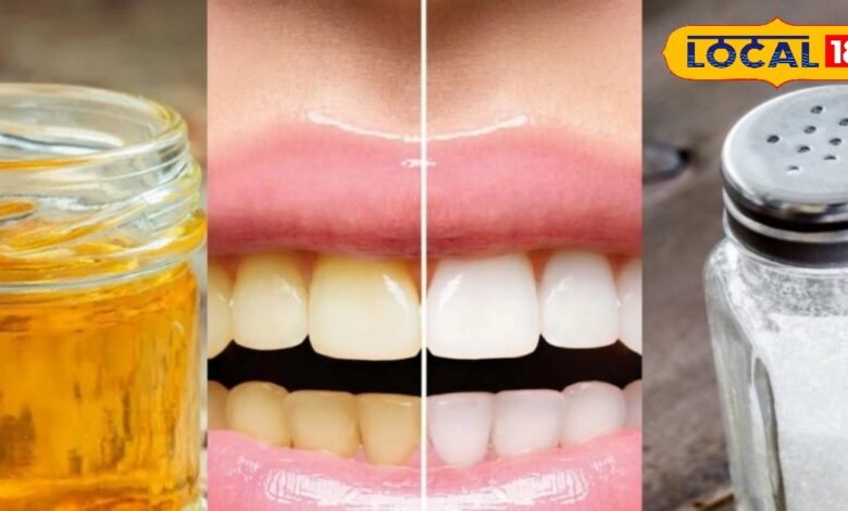 Get Shiny White Teeth Naturally with Mustard Oil & Salt