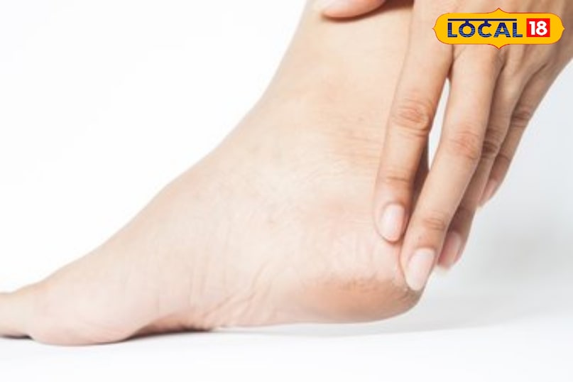 पैर धोने के बाद अच्छी तरह सुखाना चाहिए ताकि संक्रमण नही हो