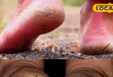 Tips and Tricks: फटी एड़ियों के लिए रामबाण हैं ये घरेलू नुस्खे; दर्द और दरारों से तीन दिन में मिल जाएगी मुक्ति! - Rajasthan News