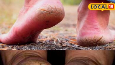 Tips and Tricks: फटी एड़ियों के लिए रामबाण हैं ये घरेलू नुस्खे; दर्द और दरारों से तीन दिन में मिल जाएगी मुक्ति! - Rajasthan News