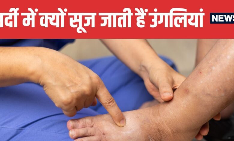 Winter Finger Swelling Doctor Explains Causes Symptoms and Prevention Tips | सर्दियों में उंगलियों में सूजन क्यों होती है | ठंड में उंगलियों की सूजन के कारण और बचाव के तरीके