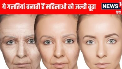 how to prevent aging| how to prevent wrinkles in 20s| महिलाओं में उम्र बढ़ने के कारण और बचाव के उपाय डॉ. तारेक पचा की सलाह