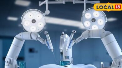 उदयपुर न्यूज : एमबी हॉस्पिटल में शुरू होगी रोबोटिक सर्जरी, करोड़ों के रोबोट अब मिनटों में करेंगे जटिल ऑपरेशन