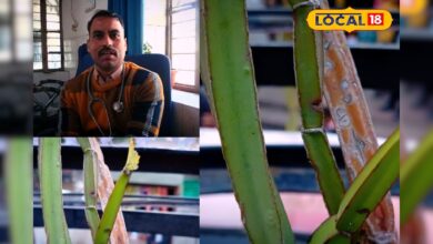 छोटे फ्रैक्चर बिना ऑपरेशन तेजी से हो रहे ठीक, लोग छोड़ रहे आधुनिक दवाएं! – News18 हिंदी