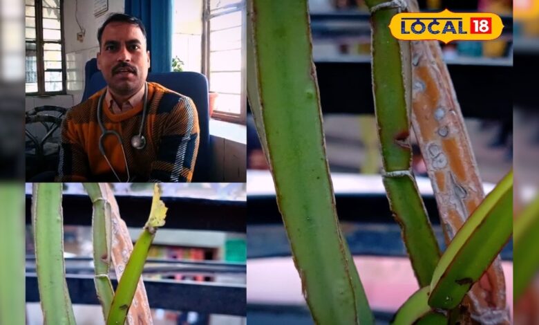 छोटे फ्रैक्चर बिना ऑपरेशन तेजी से हो रहे ठीक, लोग छोड़ रहे आधुनिक दवाएं! – News18 हिंदी