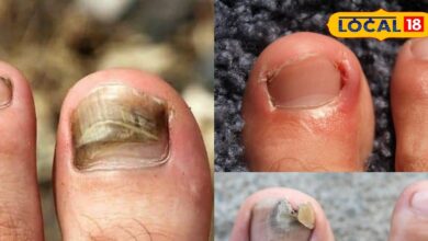 बिना चोट लगे क्यों पक जाता है पैर का अंगूठा, ये वजह पड़ जाती है भारी, छुटकारा आसान, जानें कैसे?