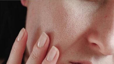 सर्दियों में इन विटामिन की कमी से त्वचा होने लगती हैं ड्राई?...एक्सपर्ट से जानें कैसे रखें अपनी स्किन का ख्याल!