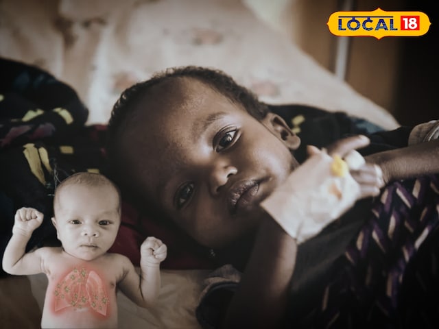 निमोनिया का साइलेंट अटैक: तेज बुखार और खांसी दिखते ही रखें सावधान