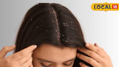 सर्दी में रूसी से बाल हो रहे हैं बेजान? ये घरेलू नुस्खे दिलाएंगे छुटकारा, नोट कर लें हेयरकेयर टिप्स - Uttar Pradesh News